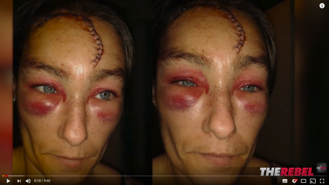 Ekstrem rasisme mot hvit kvinne får ingen oppmerksomhet